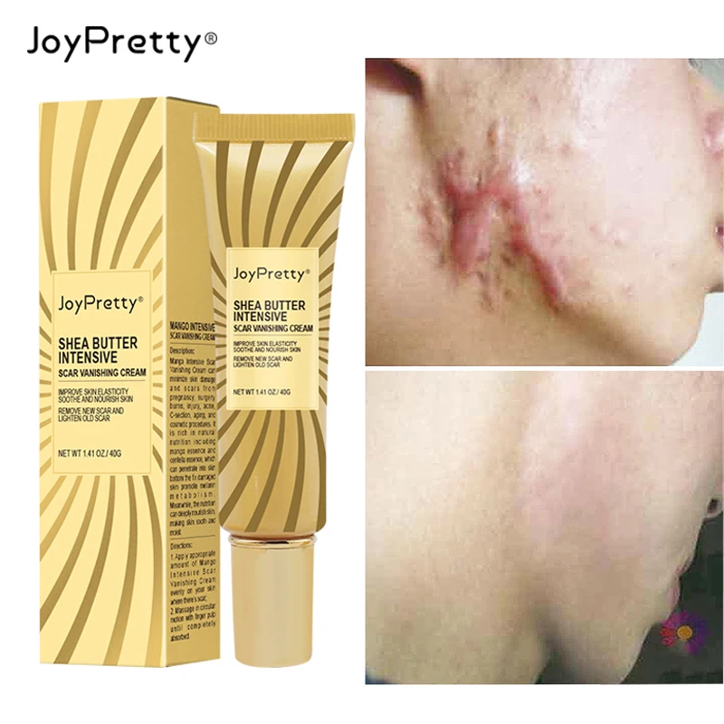 Крем для удаления шрамов от акне JoyPretty корректор пигментации отбеливание гель