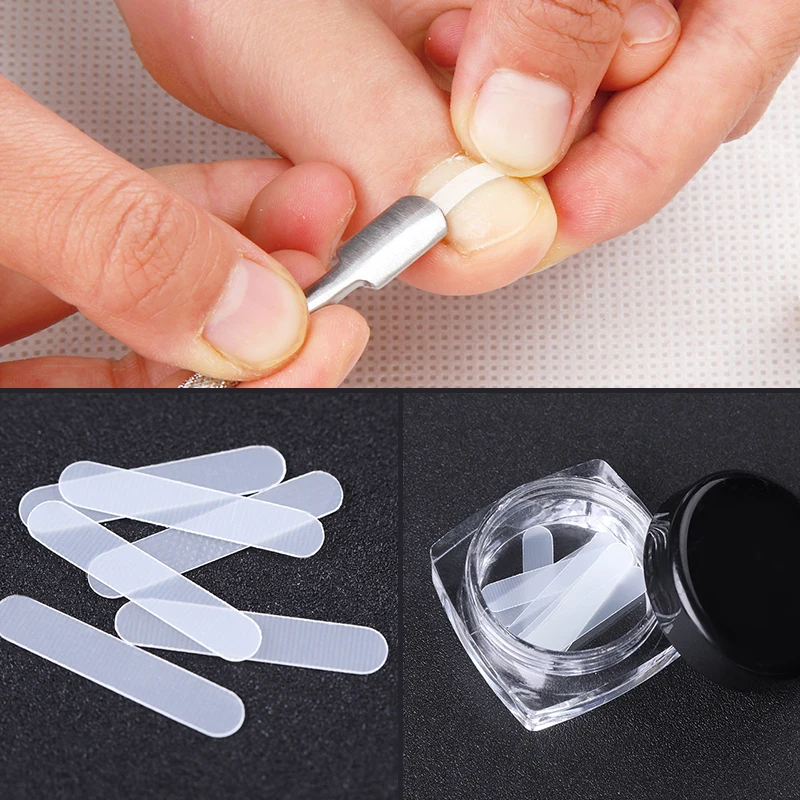 

10pcs/Box Ingrown Toe Nail Correction Sticker Patch Clear Correction File Corrector Foot Care Nail Pedicure Treatment Tools