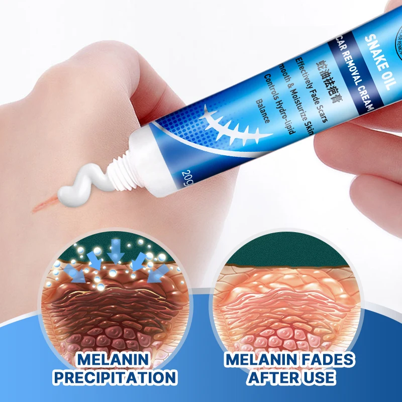 Old Scar Removal Eraser Cream Remove Burns Cuts Powerful Stretch Marks Skin Surgical Scar Repair Ointment P1177 2pcs 20g