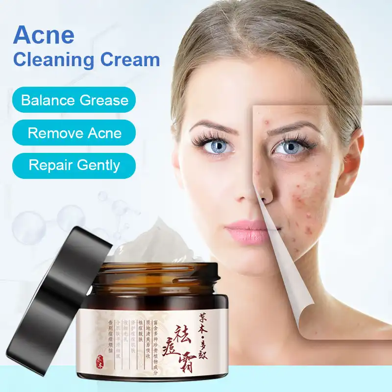 herbal acne cream price