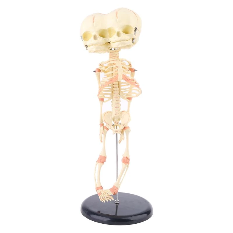 Tete De Crane Deformee Pour Bebe Humain Modele De Recherche Squelette Anatomie Du Cerveau Enseignement Affichage D Etude Aliexpress