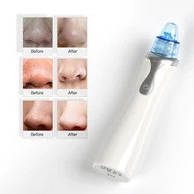 Продукт аппарат для удаления угрей поры чистка лица Уход красота оборудование