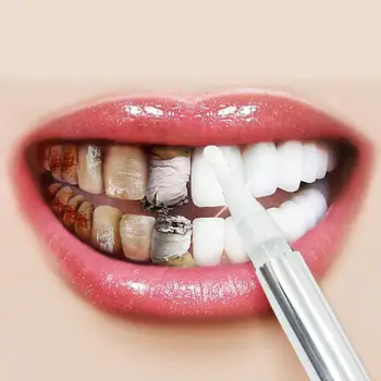 

Teeth Whitening Pen Whitening Gel Pen Teeth Stain Remover Cleaning Tool