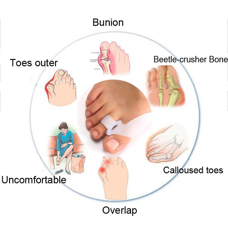 1/2pair Silicone Toe Separator Stretchers Bunion Corrector Straightener Orthopedic Hallux Valgus Correction Pedicure Feet Care
