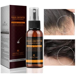 Hair Growth Essence Spray Supple Oil Control Anti-Dandruff Strengthens Hair Roots Promote Growth Prevent Hair Loss Hair Care
