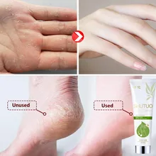 Крем для ухода за ногами, увлажняющий, питательный, для кожи, гладкий, тонкие линии, антифриз, анти-сушка, крем для ухода за кожей