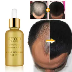 Эфирные масла для роста волос эссенция Оригинал Grandmaster анти-ВЫКЛ жидкость для роста волос
