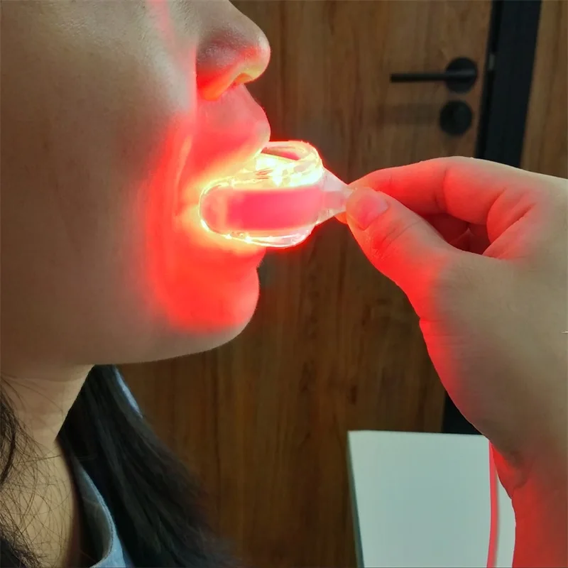 Tooth Sores Cure Reliever Gingivitis Therapy LED Red Light Therapentic Device