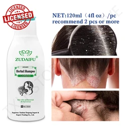 120ml（4fl oz) Zudaifu Therapeutic Shampoo Anti-Dandruff Treatment Itching and Flaking Scalp Psoriasis and Seborrheic Dermatitis