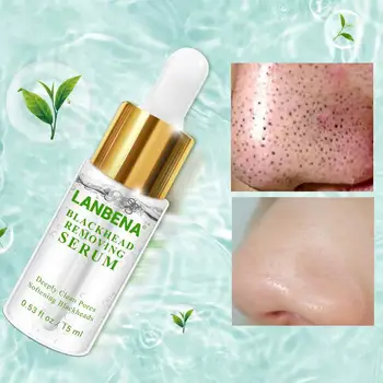 

1pc Blackhead Derived Liquid 15ml Whitehead Acne Female Cleansing Moisturizing Bleaching Deep Pores Face Gel Shrink Whiteni W5E6