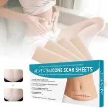 4 шт., стикер для удаления шрамов, уход за телом, самоклеющаяся наклейка для ремонта шрамов, для растягивания, ожога, удаления шрамов, красота, пластырь