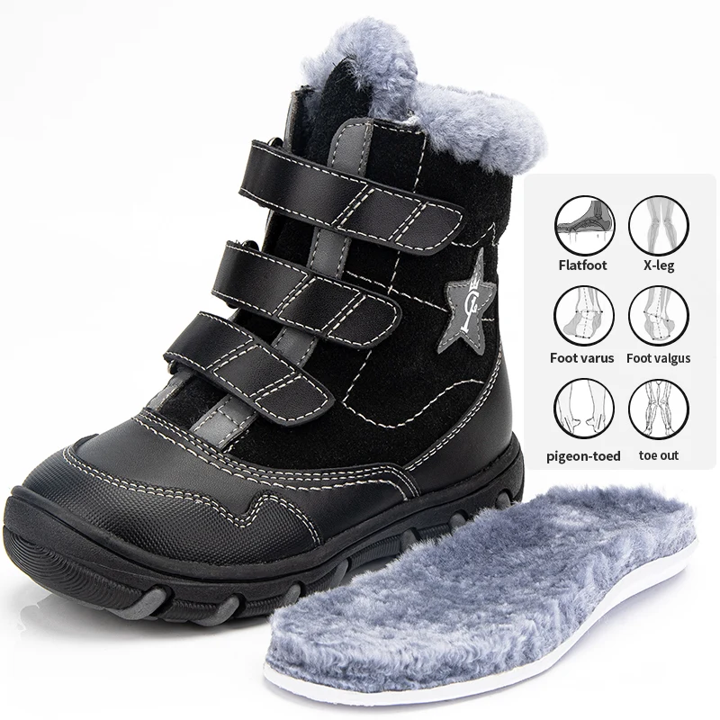 

Princeprd New Winter Children's Orthopedic Supportive Shoes for Girls Boys 100% Natural Fur Star Pattern Orhopedic Boots kids