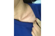 9 engranajes bolígrafo de Plasma láser Etiqueta de piel de Topo removedor de pecas verruga tatuaje mancha removedor multifunción LCD herramienta de belleza