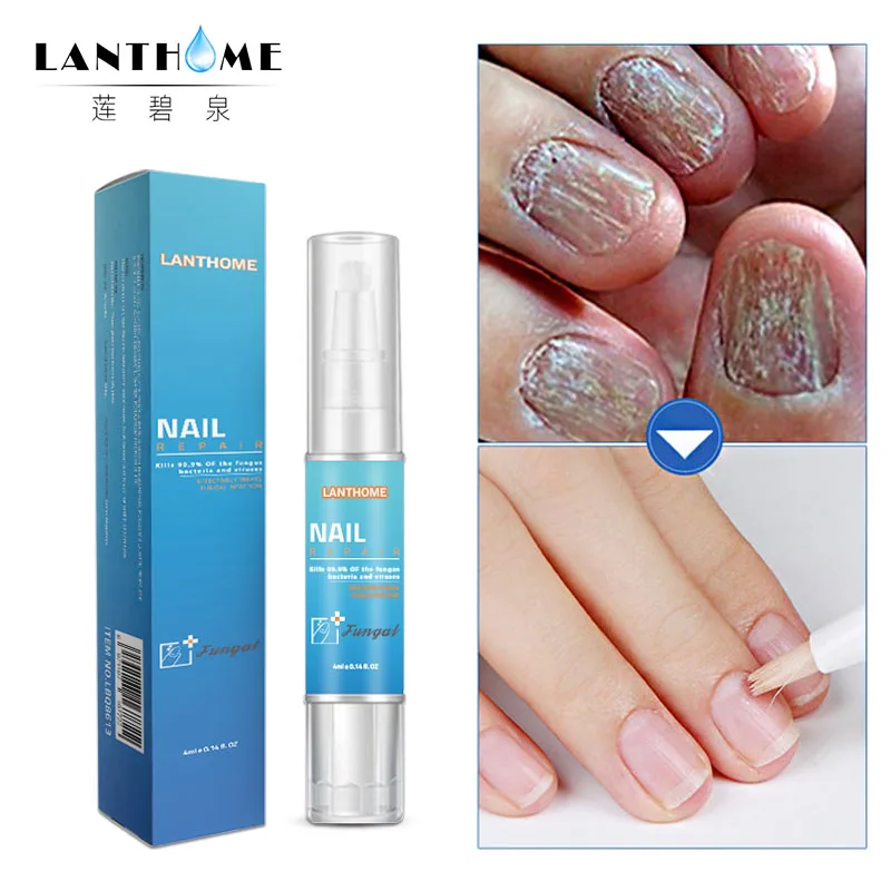 Nail Treatment Pen Onychomycosis Paronychia Anti Fungal Nail Infection Chinese Herbal Toe Fungus CareRepair Serum 10PCS nail fungus treatment nail care oil nail cuticle oil pen nail care kit