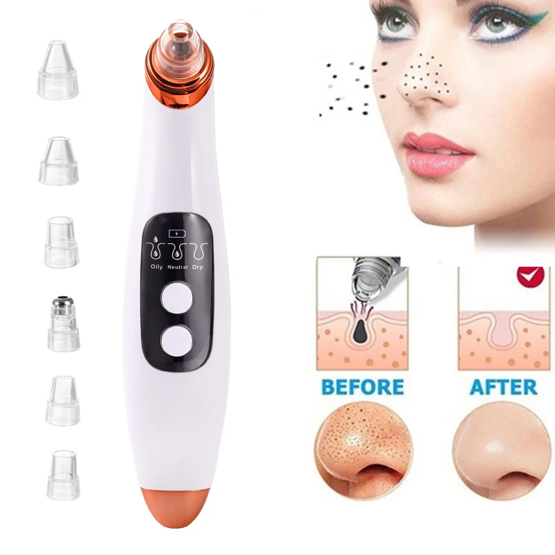 skin care beauty health Средство для удаления черных точек электронный прибор ухода за