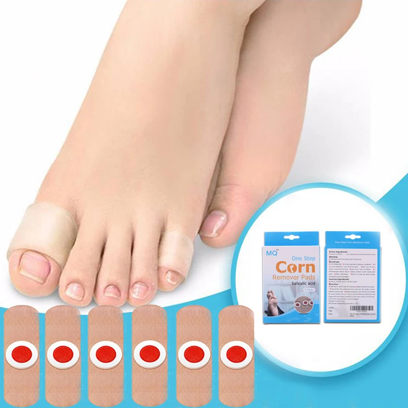 

6 pcs/box Foot Corn Removal Plaster Warts Thorn Patch Feet Callus Remove Soften Skin Cutin Pain Relief Stickers