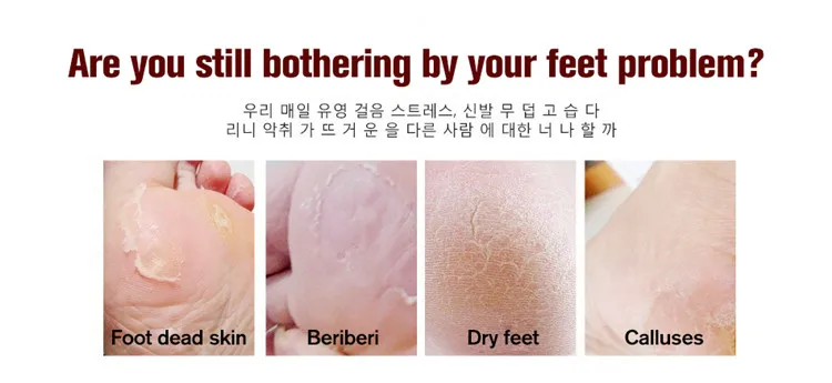 OEM Shea Butter tender massage exfoliator foot cream