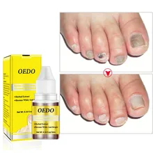 Лечение ногтей эфирное масло эссенция травяной Анти Гриб Антибактериальный питательный увлажняющий отбеливающий Уход за ногами аксессуар