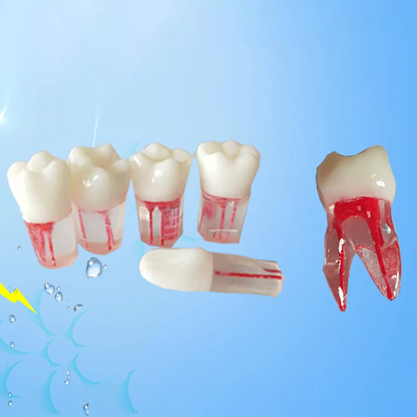5pcs/set Dental Tooth Model Root Practice Pulp Cavity Clear Resin Teaching Teeth Model For Student Study Science Equipmenent