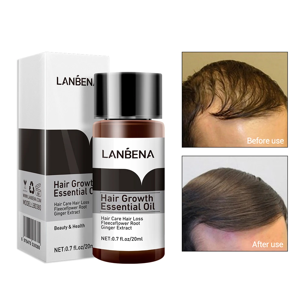 Hair Growth Serum, Hair Growth Spray, Hair Care Oil, Hair Growth Cream, LANBENA, 2PCS, Fast Powerful, Nourish Oil Liquid, Preventing Hair Loss