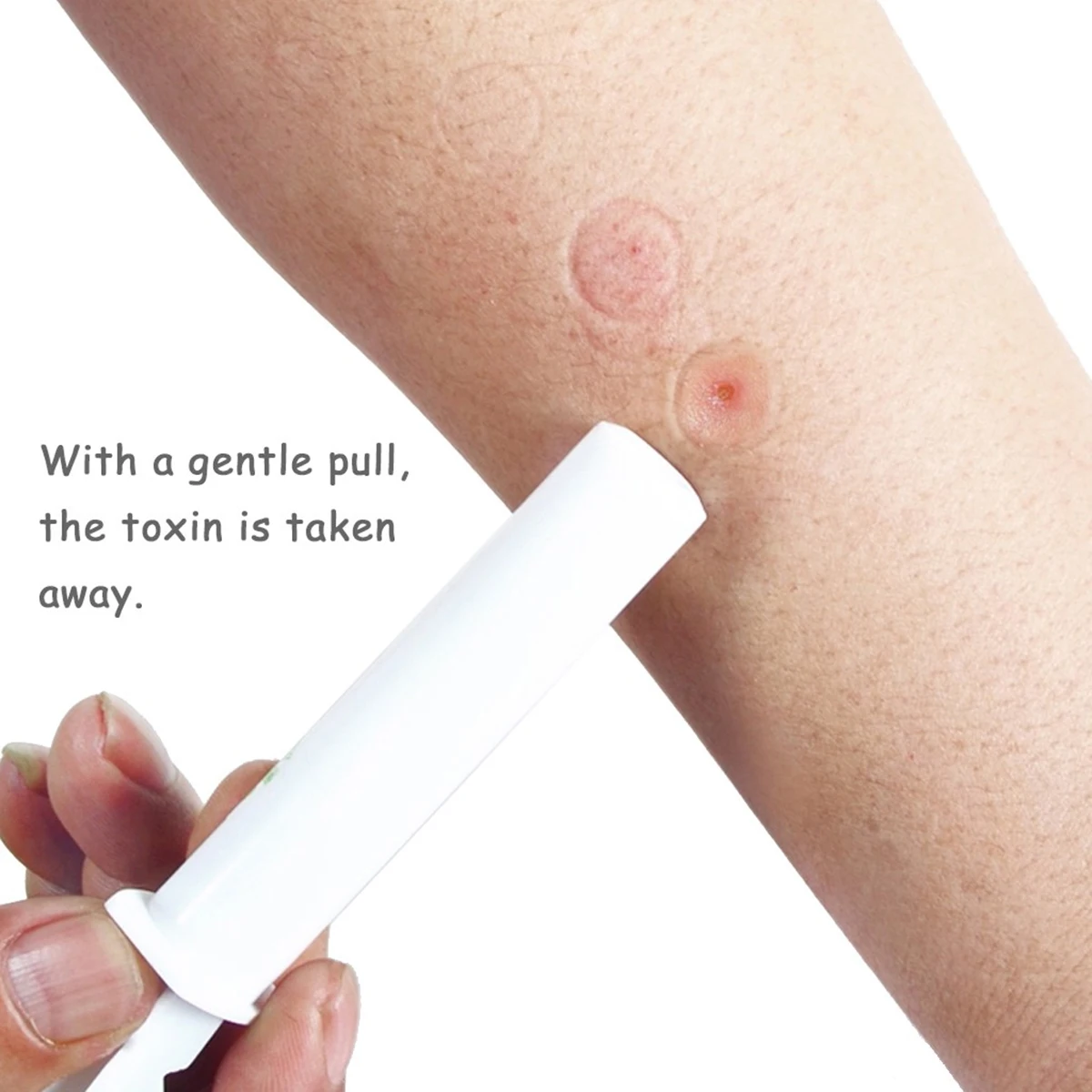 1 шт. вакуумного укуса комара на открытом воздухе пипетки экстрактор вакуумный