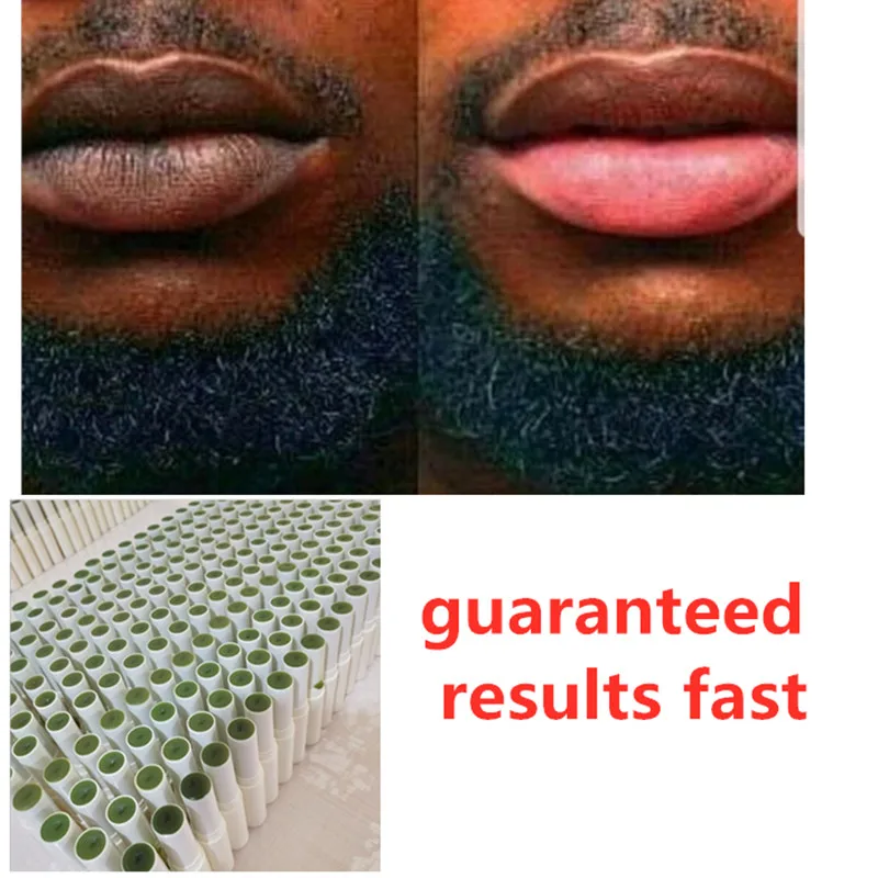 1pcs Of Lips Pink Fresh Lightening Bleaching Cream Treatment Remove Dark Smoke Lips lip oil