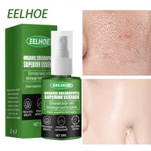 

30ml Pore Shrink Serum Chlorophyll Natural Detox Nourish Moisturizing Dryness Repair Face Pores Treatment Essence Skin Care