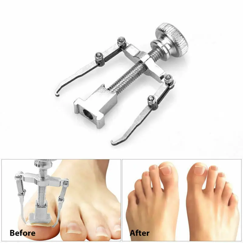 Cuticle Remover Kit Nail Clipper Trimmer for Cuticle Ingrown Nails Pedicure & Manicure Corrector Fixer Foot Care Tool