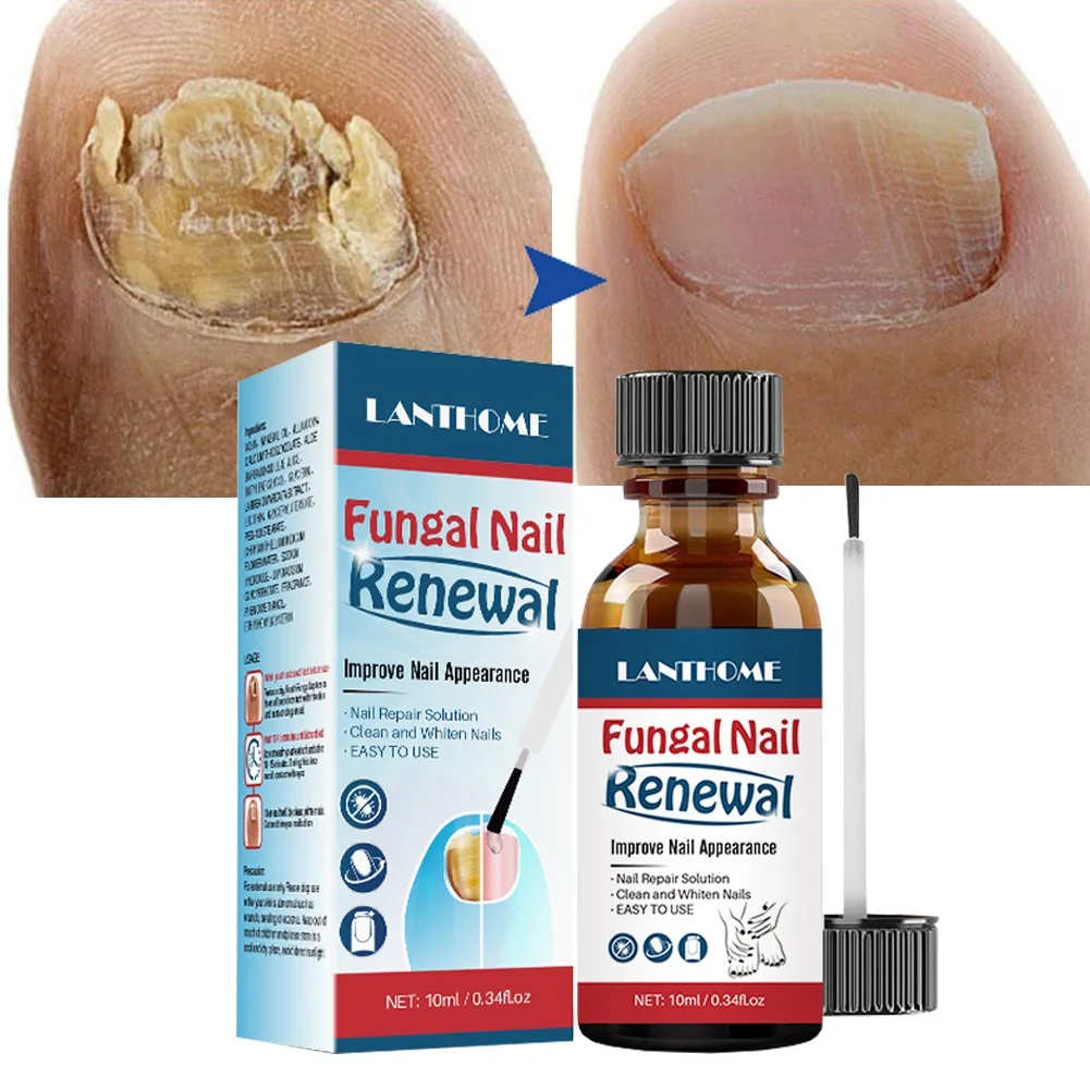 Fungal Nail Serum Nails Fungus Treatment Essence Brush Anti Infection Regenerate Foot Toe Care