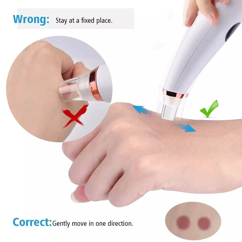 Black Dots Vacuum Pore Cleaner Nose Black Point Remover Blackhead Acne Pimple Removal Suction Extractor Facial Beauty Tools SPA