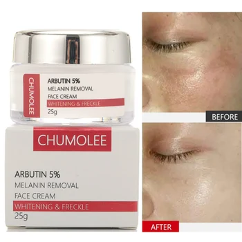 

CHUMOLEE alpha Arbutin 5% Whitening Freckle Facial Cream Melasma Remove Acne Dark Spots Melanin Pigment Moisturizer Face Care
