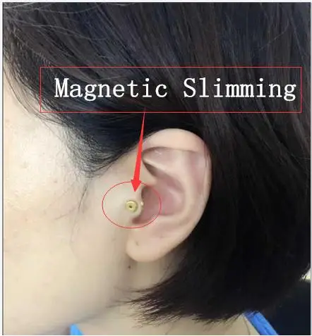 10 компл./лот магнитных пластырей для ушной терапии саморегулируемый