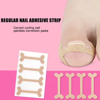 

Professional Ingrown Embedded Toe Nail Corrector Sticker Toenail Care Pedicure Thumb Treatment Patch Curl Correction Sticker
