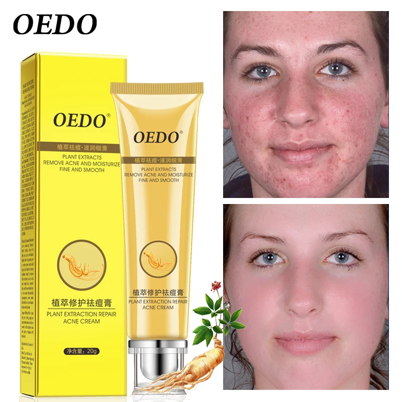 

OEDO Ginseng Repair Acne Treatment Cream Plant Oil Control Shrinking Pore Gel Moisturizing Acne Pimple Treatment Skin Care