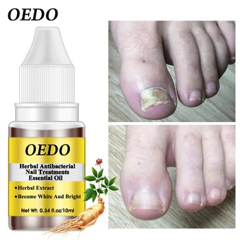 

Herbal Antibacterial Nail Treatments Essential Oil Herbal Extract Nail Fungus Art Repair Tools Foot Nail Care Repair Serum