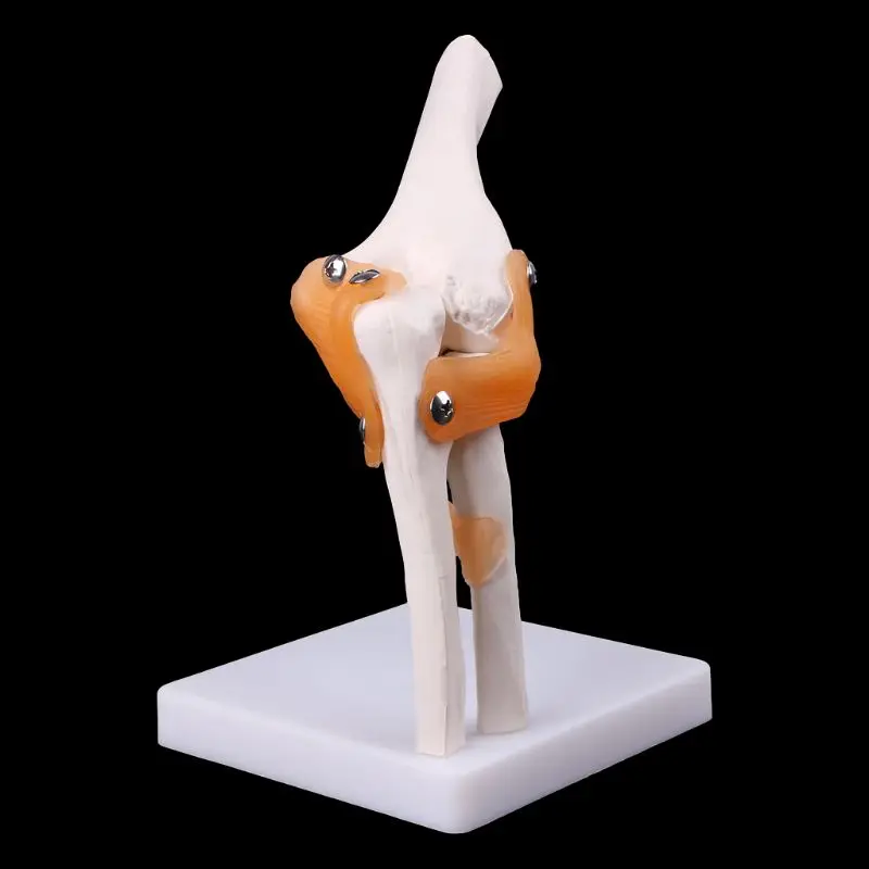 

Human Elbow Joint Model Anatomical Anatomy Elbow Joint Medical Model Orthopedics