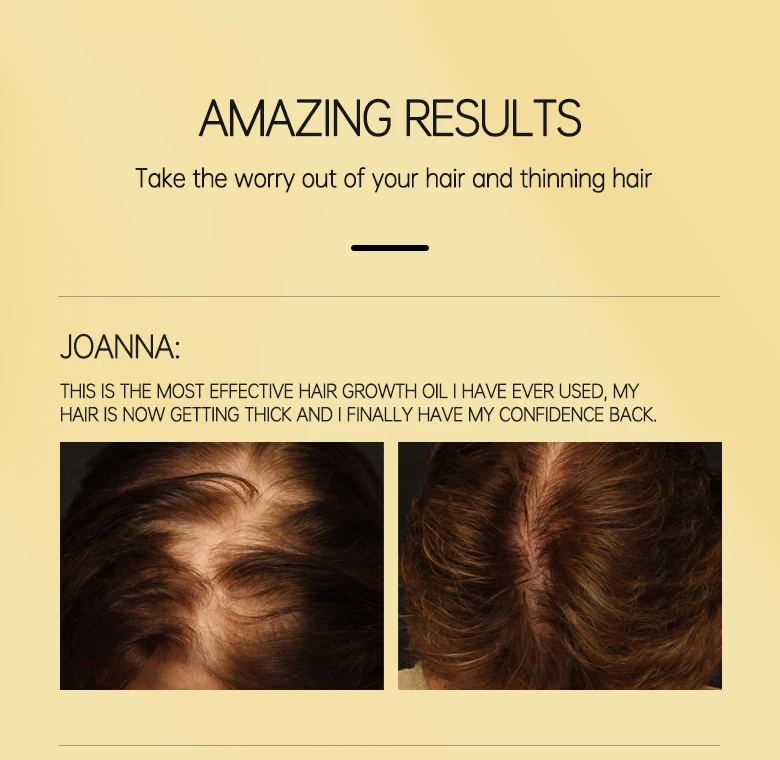 Hairinque Vitamin B7 Hair Growth Oil Prevent Hair Loss Serum Scalp