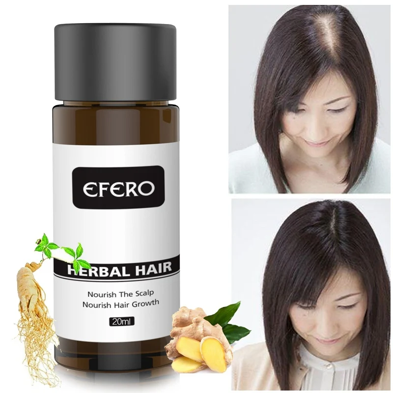 20 мл от выпадения волос для роста волос эфирное масло питает масло для волос мощная эссенция роста предотвращает облысение