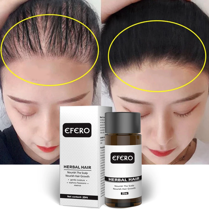 EFERO Сыворотка для роста волос мощный продукт против выпадения волос масло для бороды Сыворотка для роста эфирное масло лечение роста волос уход за волосами TSL