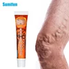 1Pcs 20g Varicose Veins Ointmnet Vasculitis Phlebitis Spider Cream Varicosity Angiitis Removal Herbal Medical Plaster ► Photo 1/6