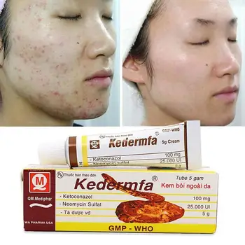 

5g Vietnam Kedermfa 100% Original Snake Oil Hand Skin Face Care Cream Snake Balm Ointment Nourishing Scar Rejuvenate Burn Cream