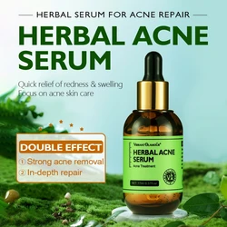 17ml Herbal Acne Treatment Serum Oil Control Brighten Nourish Whitening Shrink Pores Remove Scars Marks Skin Care