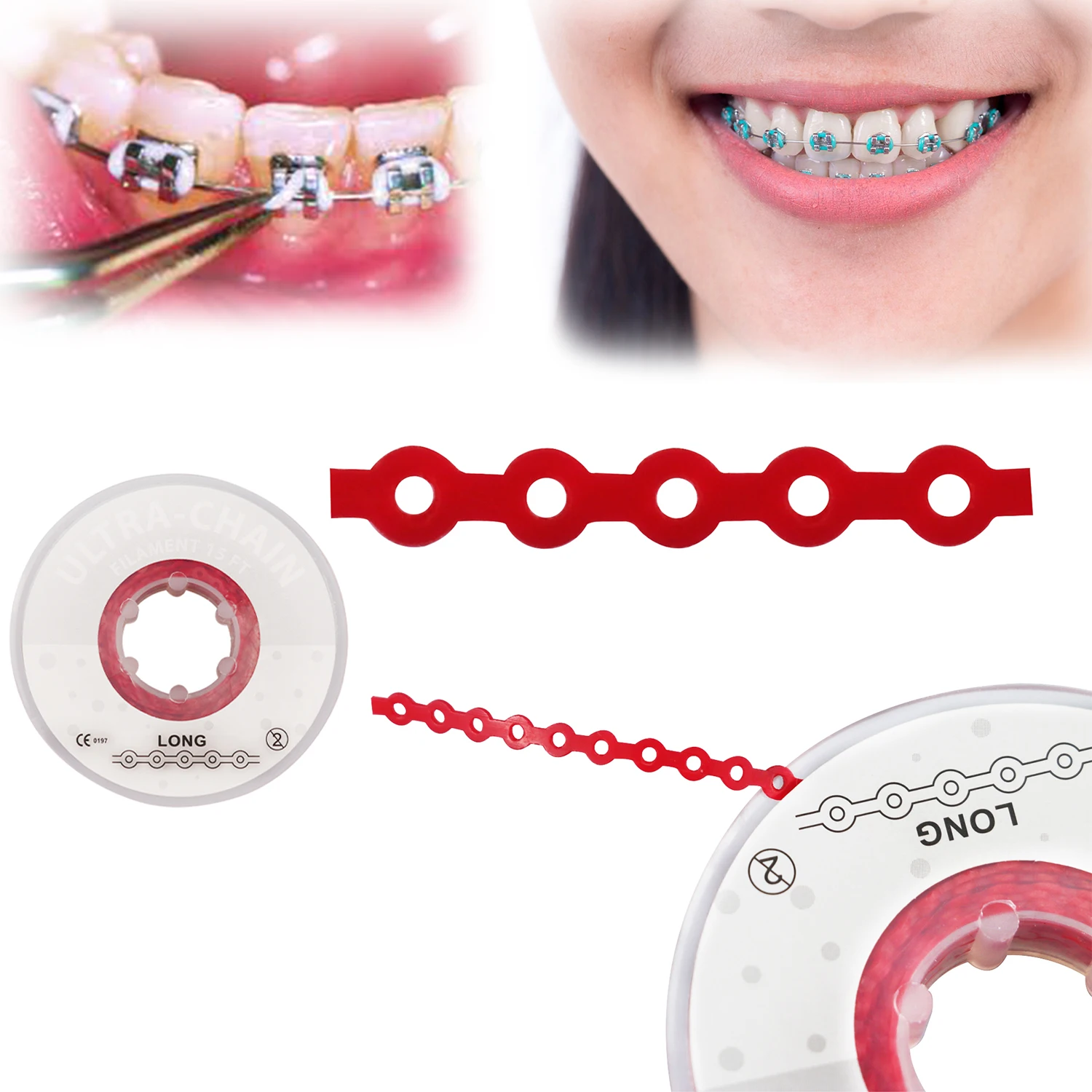 Orthodontic Power Chain ubicaciondepersonas.cdmx.gob.mx