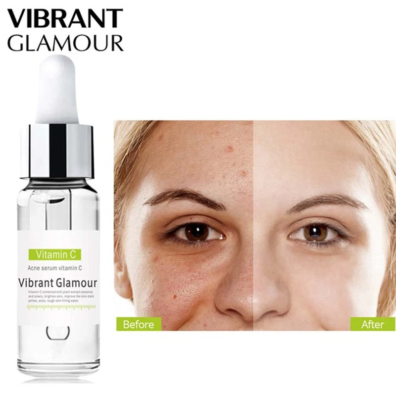 VIBRANT GLAMOUR Vitamin C Whitening Face Serum Hyaluronic Acid Cream Remover Acne Treatment Fade Dark Spots Anti-Aging Skin Care VIBRANT GLAMOUR Vitamin C Whitening Face Serum Hyaluronic Acid Cream Remover Acne Treatment Fade Dark Spots Anti-Aging Skin Care