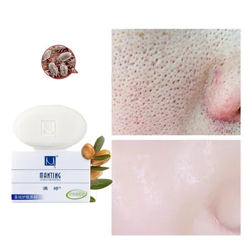 

Men and women acne cleanser soap treatment of acne black-headed red scars Plant Extraction Melatonin for Antipruritus Whitening