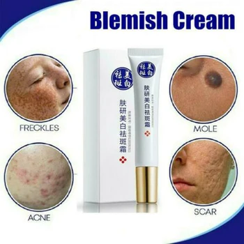 

2019 Skin Cream Anti Acne Scar Blemish Stretch Marks Freckle Removal Face Cream