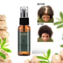 30 мл роста волос Эфирная масляная Эссенция от выпадения волос жидкость красивые, густые рост бороды Уход за жирной кожей хорошее использование