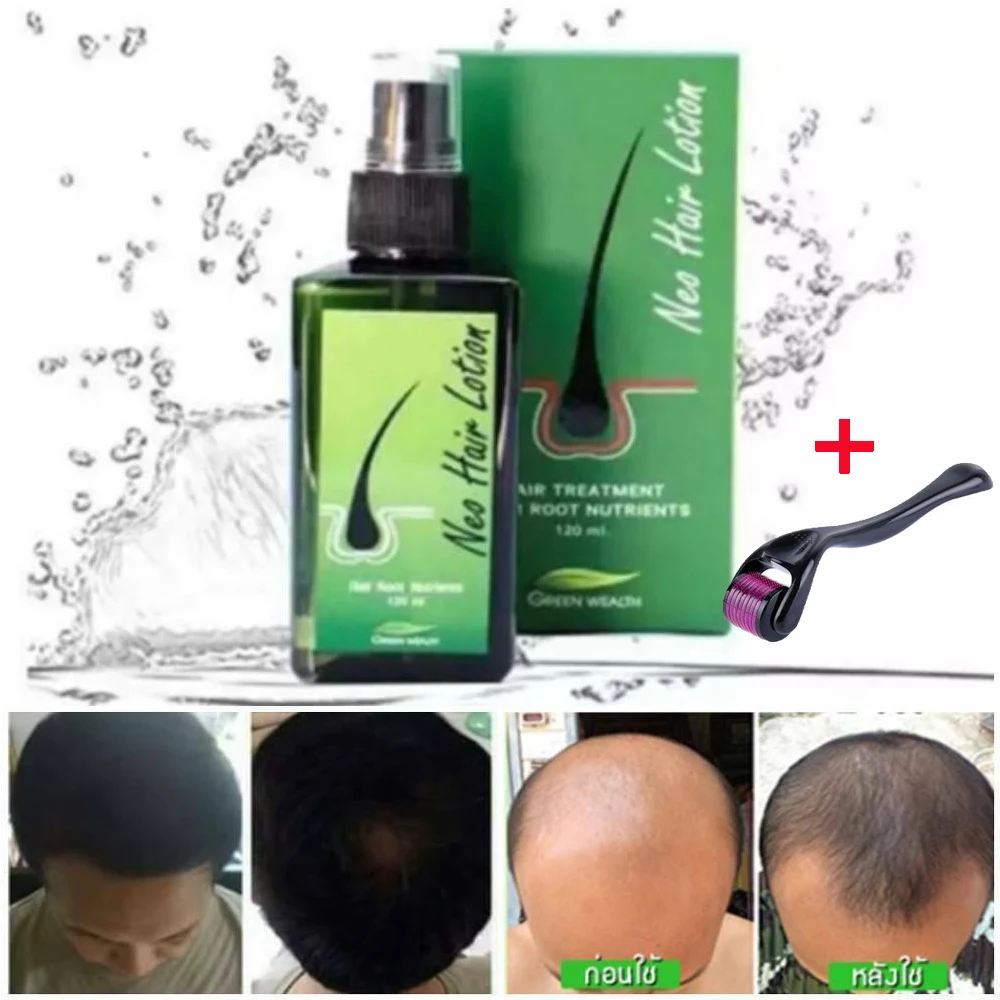Neo Hair Lotion 120ml Hair Treatment Hair Root Nutrients Anti-loss Beard  Regrowth Original Thailand - Hair Loss Product Series - AliExpress