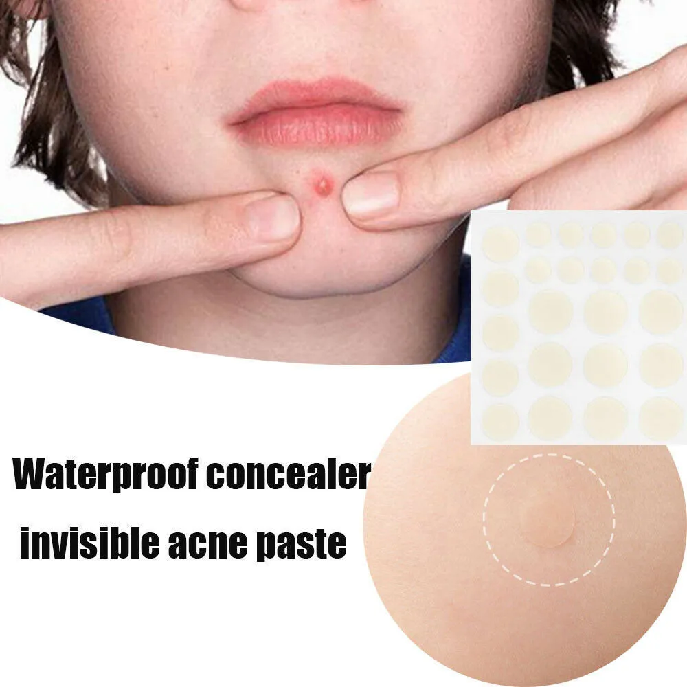 

24Pc New Pimple Master Patch Face Spot Scar Care Treatment Stickers Facial Skin Care Blackhead Removal Freckle Patches Acne Mask