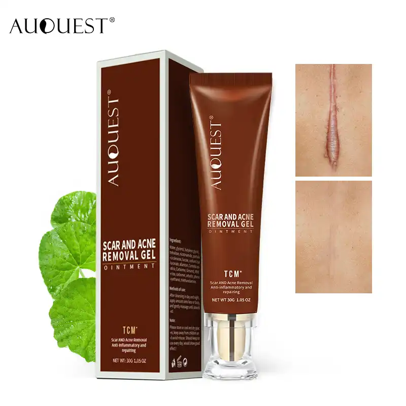 acne removal ointment